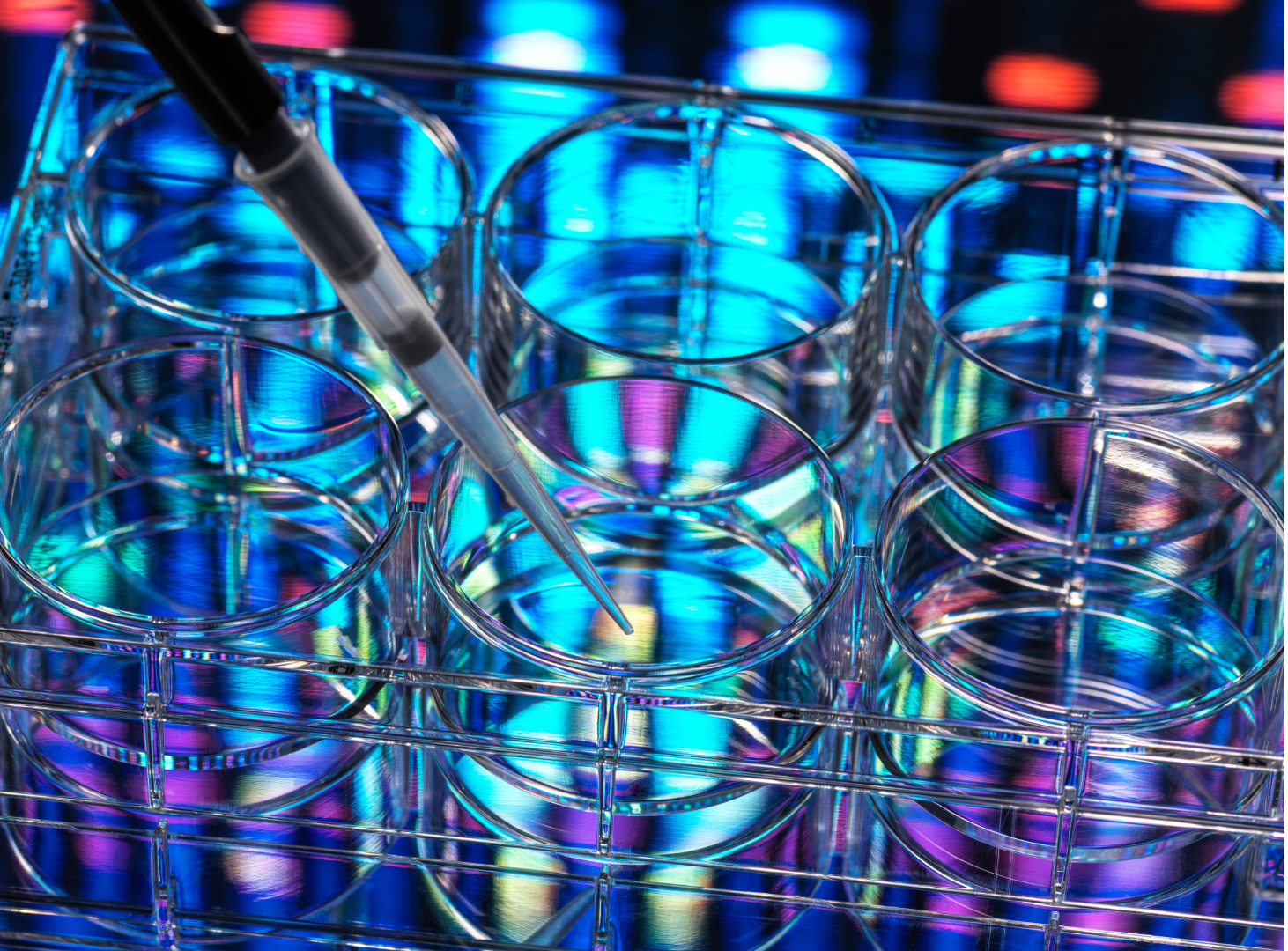 Laboratory testing tray with sample cups for water analysis and Legionella detection.