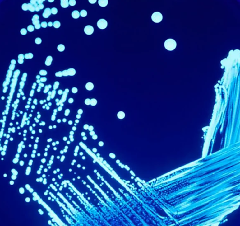 Legionella Management