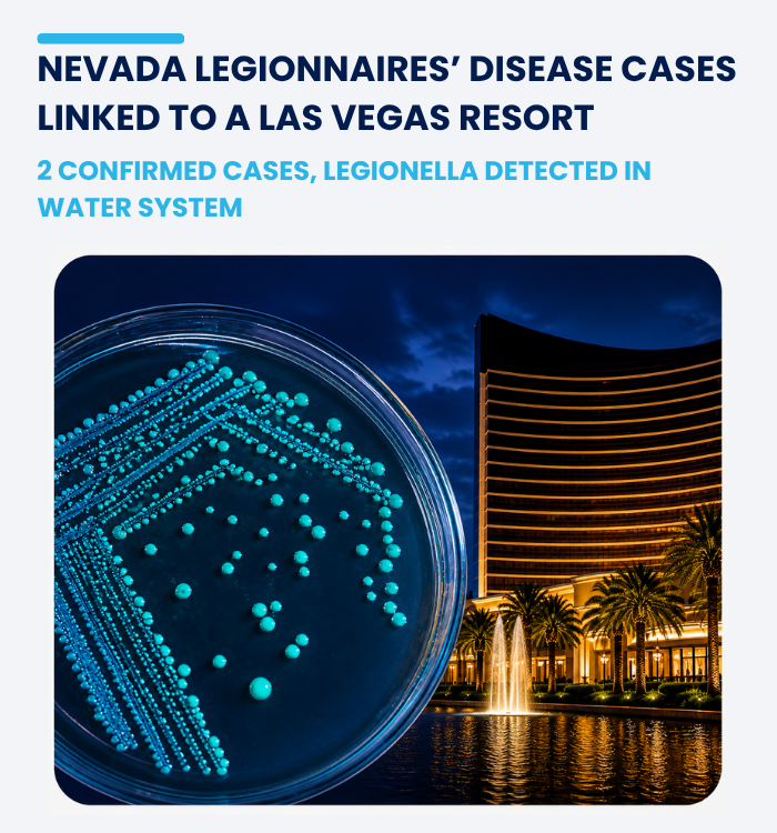Legionella detected in Las Vegas resort water system